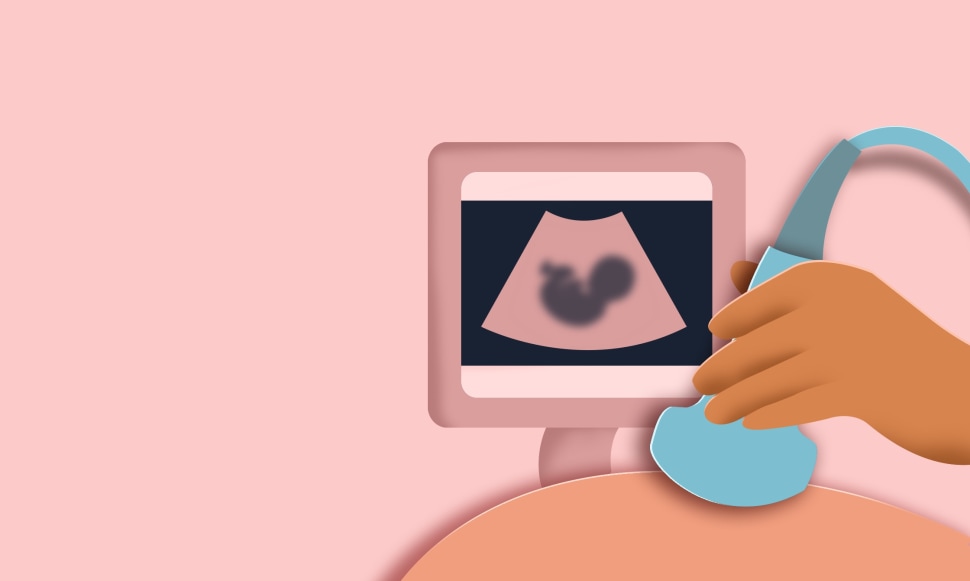 Gynaecologist Consultation in undefined
